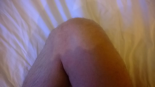 Knie