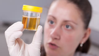 Urinfarbe als Symptom fr Krankheiten
