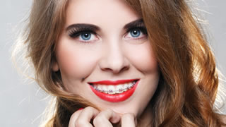 Mit einer Zahnspange können Zahnfehlstellungen korrigiert werden. Die Kieferorthopädie sorgt für ein strahlendes Lächeln.