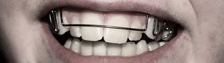 „Die Zahnspange für Erwachsene funktioniert problemlos.“
